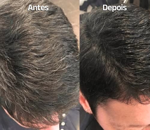 Shampoo Unissex Nova Hair - Clube Boss